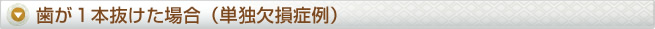 歯が１本抜けた場合（単独欠損症例）